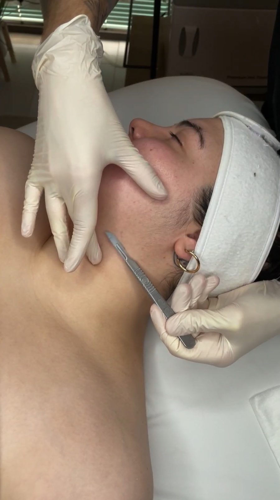 Dermaplane facial treatment removing peach fuzz and dead skin at Awaken Zen Spa Mesa