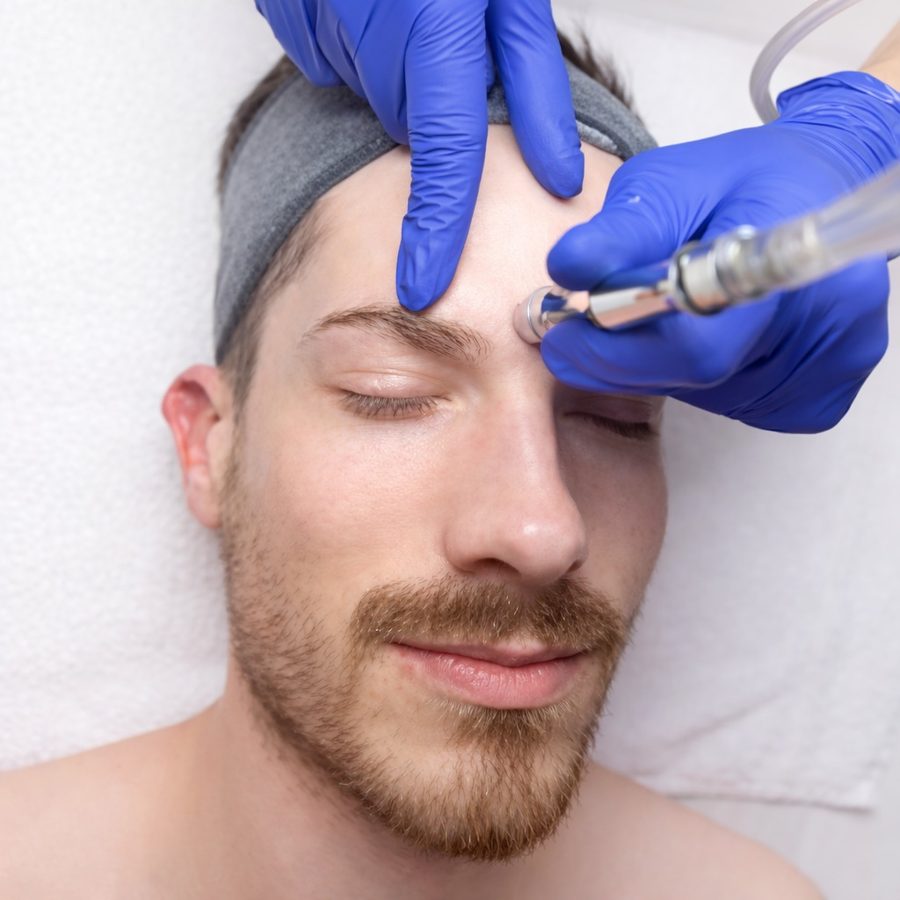 Microdermabrasion diamond tip treatment on male client's forehead at Awaken Zen Spa in Mesa, AZ